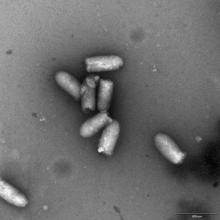Electron micrograph of VSV-GP
