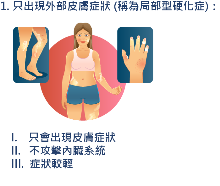 2020 世界硬皮病日：硬皮病懶人包 | Boehringer Ingelheim TW