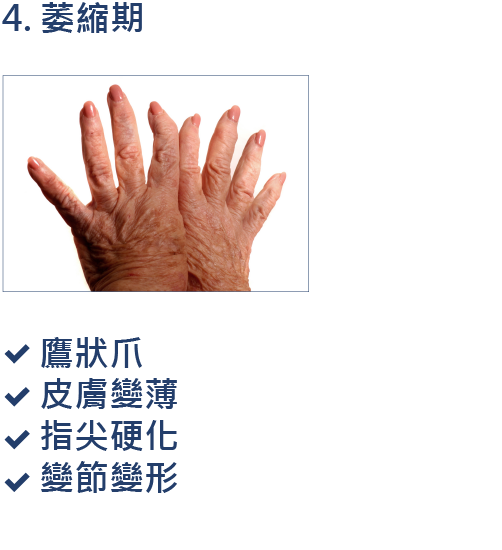 2020 世界硬皮病日：硬皮病懶人包 | Boehringer Ingelheim TW